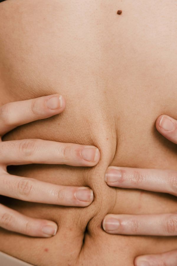 Medically-Supervised Weight Management Programs