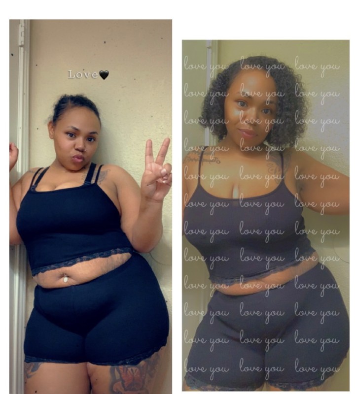 Houston Weight Loss